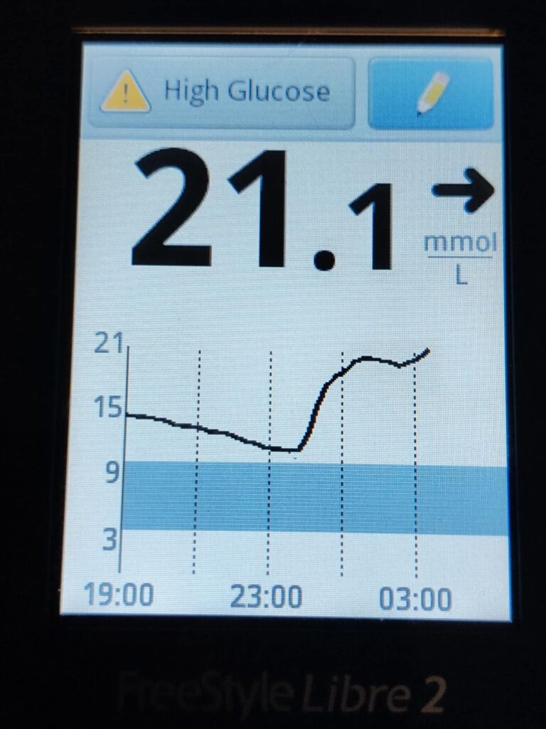 A screenshot of a blood sugar monitor showing 21.1 mmol/L and a graph that reached 11.2 mmol/L.